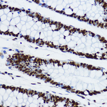 Anti-Acetyl-Histone H3-K9 Antibody (CAB7255)