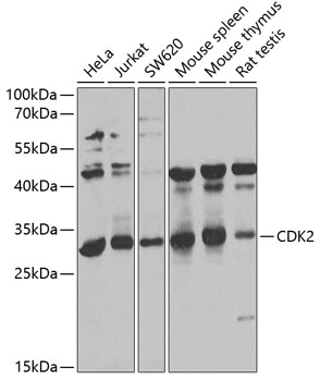 Anti-CDK2 Antibody (CAB0294)