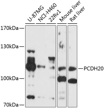 Anti-PCDH20 Antibody (CAB10428)