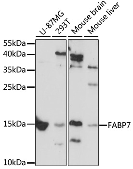 Anti-FABP7 Antibody (CAB11604)