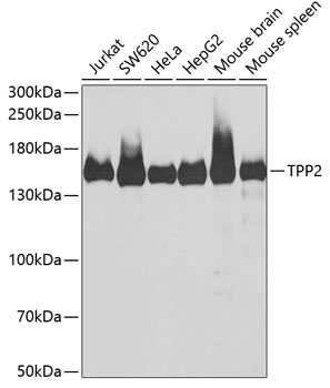 Anti-TPP2 Antibody (CAB6421)