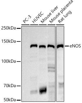 Western blot analysis of extracts of various cell lines, using eNOS antibody at 1:1000 dilution. Secondary antibody: HRP Goat Anti-Rabbit IgG (H+L) at 1:10000 dilution. Lysates/proteins: 25ug per lane. Blocking buffer: 3% nonfat dry milk in TBST. Detection: ECL Basic Kit. Exposure time: 180s.
