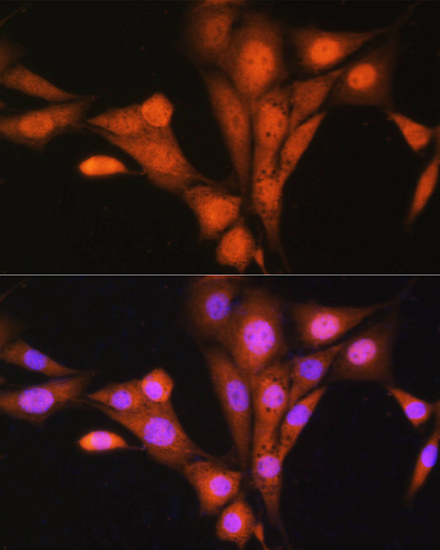 Anti-ASNA1 Antibody (CAB3746)