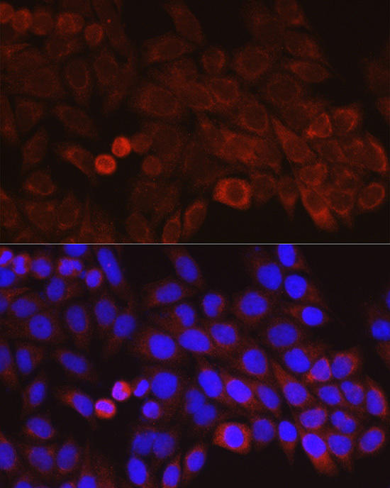 Immunofluorescence analysis of HeLa cells using GSDMD Rabbit mAb at dilution of 1:100 (40x lens). Blue: DAPI for nuclear staining.