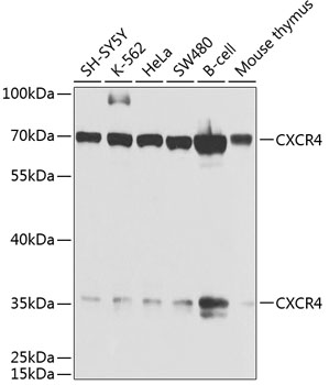 Anti-CXCR4 Antibody (CAB1303)