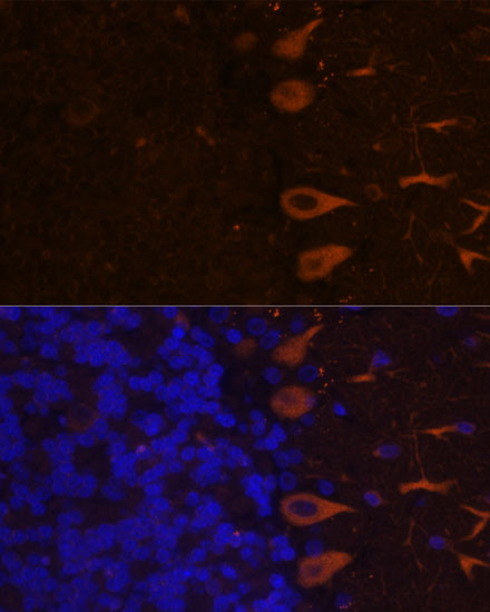 Anti-KAL1 Antibody (CAB16389)