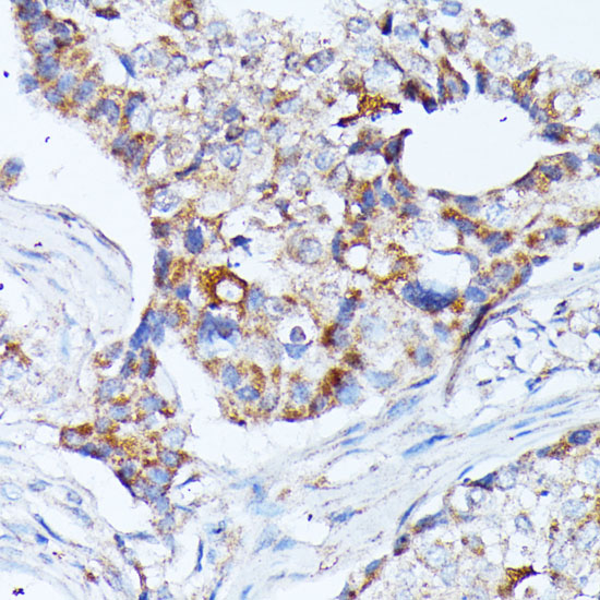 Anti-KCNJ15 Antibody (CAB15282)