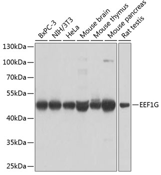 Anti-EEF1G Antibody (CAB7891)