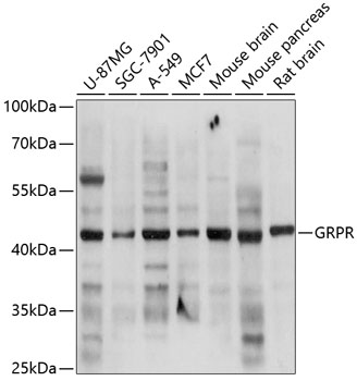 Anti-GRPR Antibody (CAB2940)