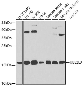 Anti-UBE2L3 Antibody (CAB4175)