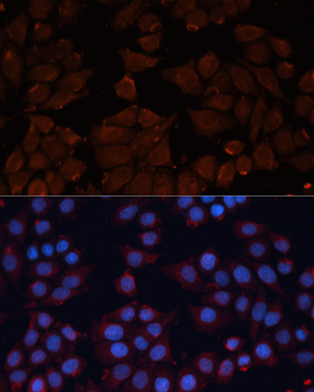 Anti-ADAM12 Antibody (CAB7940)