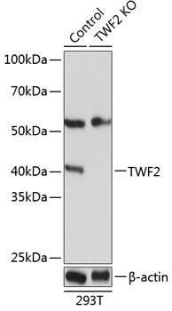 Anti-TWF2 Antibody [KO Validated] (CAB19897)