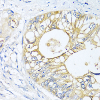 Anti-GNAI3 Antibody (CAB1922)