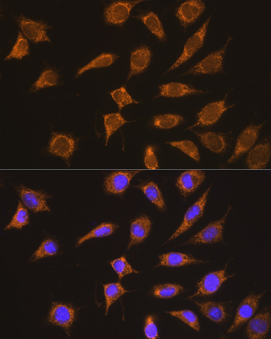 Anti-KNG1 Antibody (CAB1670)