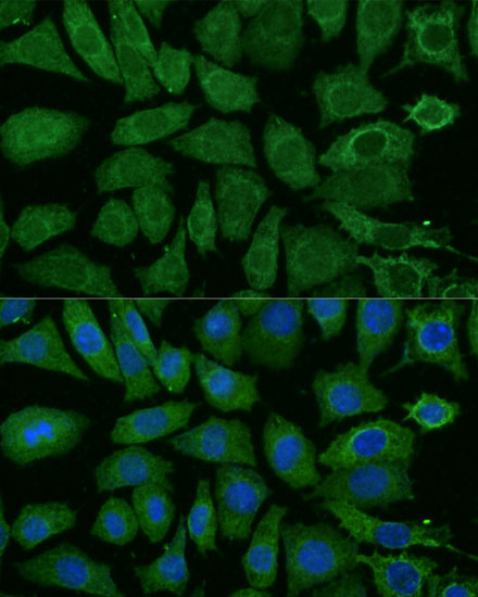 Anti-NDUFB4 Antibody [KO Validated] (CAB13820)