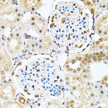 Anti-PNKP Antibody (CAB6693)