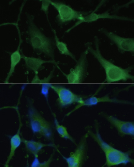 Anti-FABP7 Antibody (CAB11604)