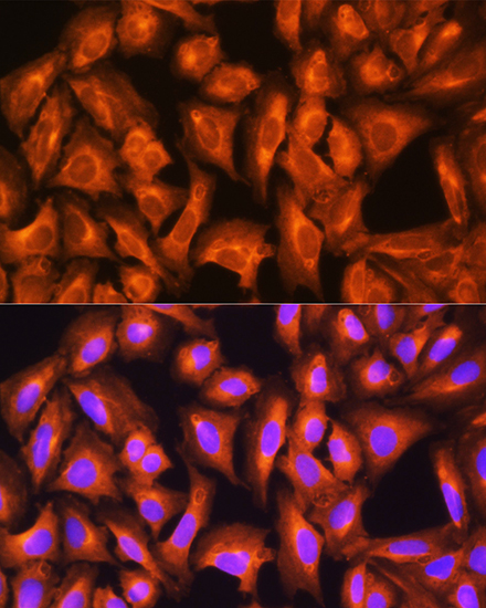 Anti-GNAS Antibody (CAB5546)