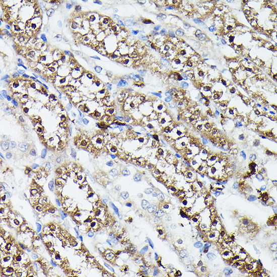 Anti-Ferritin Heavy Chain Antibody (CAB1144)