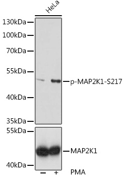 Anti-Phospho-MAP2K1-S217 Antibody (CABP0062)