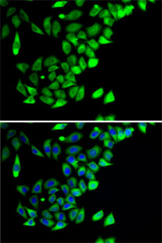 Anti-PTGES2 Antibody (CAB7137)