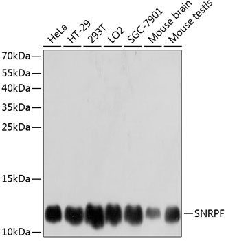 Anti-SNRPF Antibody (CAB12162)