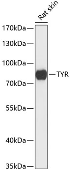 Anti-TYR Antibody (CAB13608)