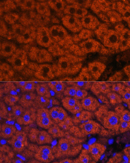 Anti-F2 Antibody (CAB12382)