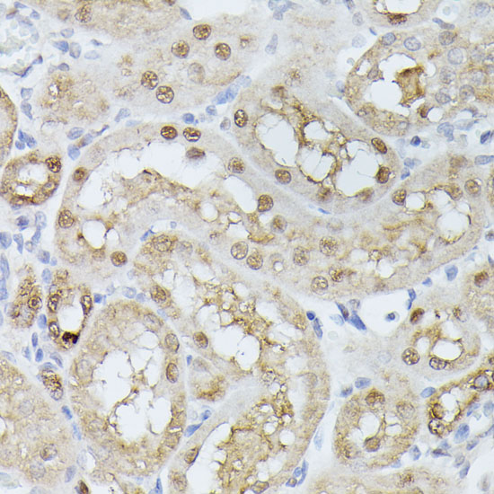 Anti-TPI1 Antibody (CAB15733)