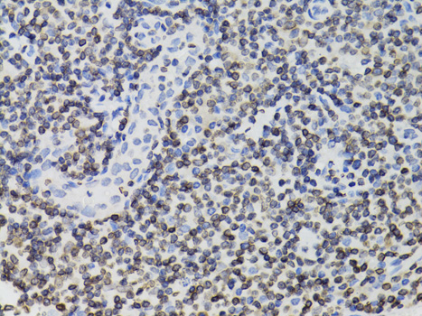 Anti-TMPO Antibody [KO Validated] (CAB2534)