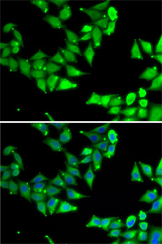 Anti-OGFR Antibody (CAB7074)