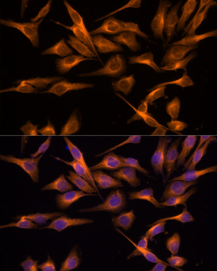 Anti-UNG Antibody (CAB13155)