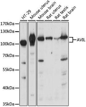 Anti-AVIL Antibody (CAB15785)