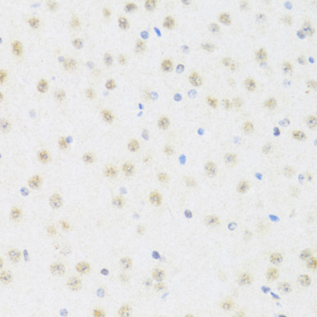 Anti-DDX50 Polyclonal Antibody (CAB8628)