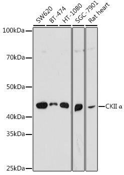 Anti-CKII Alpha Antibody (CAB17466)