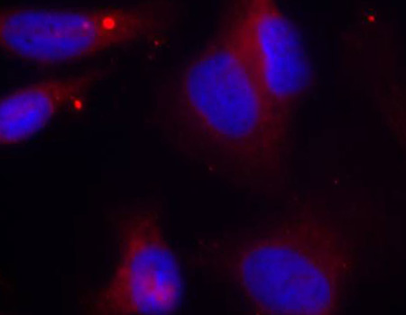 Anti-Phospho-ZAP70-Y319 Antibody (CABP0467)