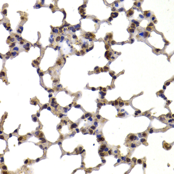 Anti-TXN Antibody (CAB7638)