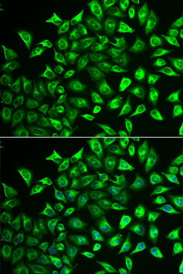 Anti-MMRN1 Antibody (CAB6658)