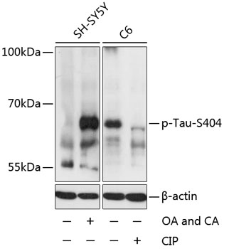 Anti-Phospho-MAPT-S404 Antibody (CABP0170)