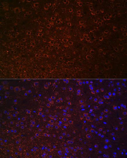 Anti-SLC6A3 Antibody (CAB15236)