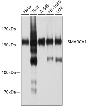 Anti-SMARCA1 Antibody (CAB10248)