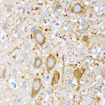 Anti-HSPH1 Antibody (CAB6622)