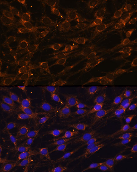 Anti-PREPL Antibody (CAB14348)