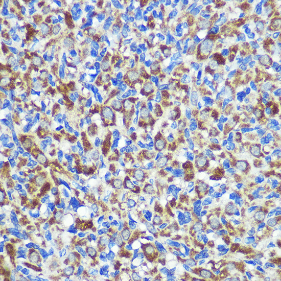 Anti-ABCA1 Antibody (CAB16337)