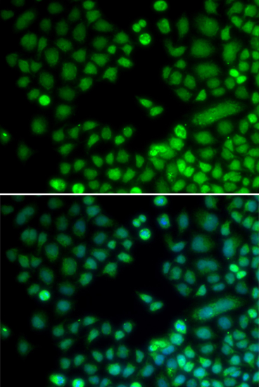 Anti-RAD9A Antibody (CAB1890)