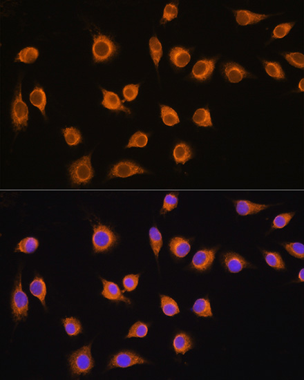 Anti-SLC20A1 Antibody (CAB4117)