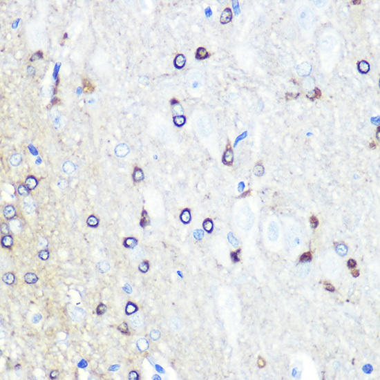 Tau antibody, part of the Neuroscience antibody sampler pack range