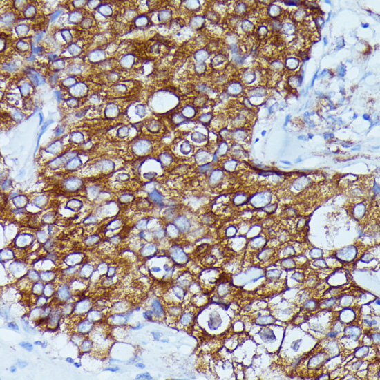 Anti-DDX6 Antibody (CAB16270)