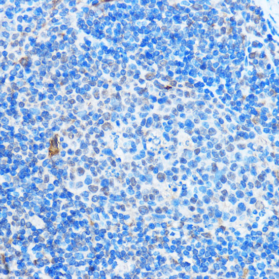 Anti-ADAR Antibody (CAB7869)