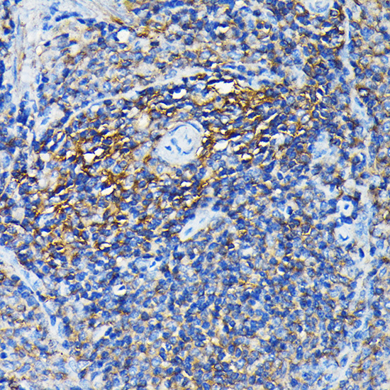 Anti-PRC1 Antibody (CAB7029)